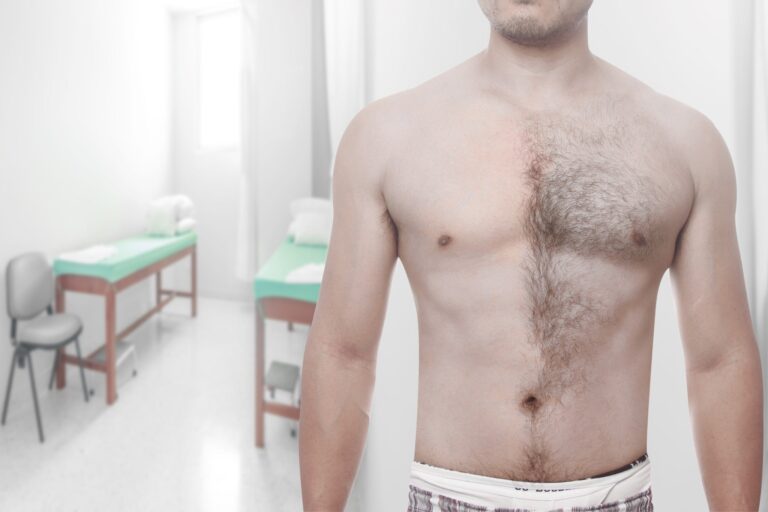 Top 4 des zones les plus populaires pour les hommes pour l'épilation au laser